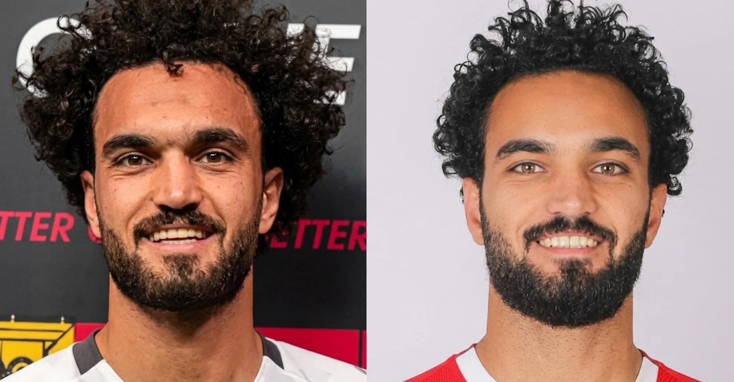 مصطفى زيكو قبل وبعد